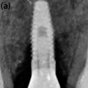 a Baseline radiographic examination.